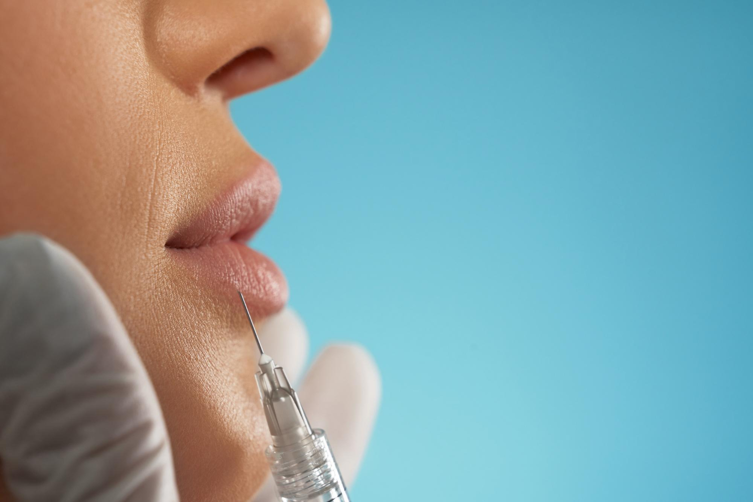 Aumento de labios natural en Bilbao