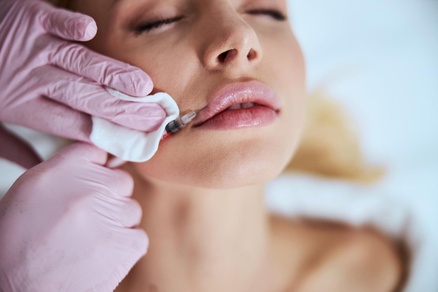 labios naturales con ácido hialurónico en Bilbao